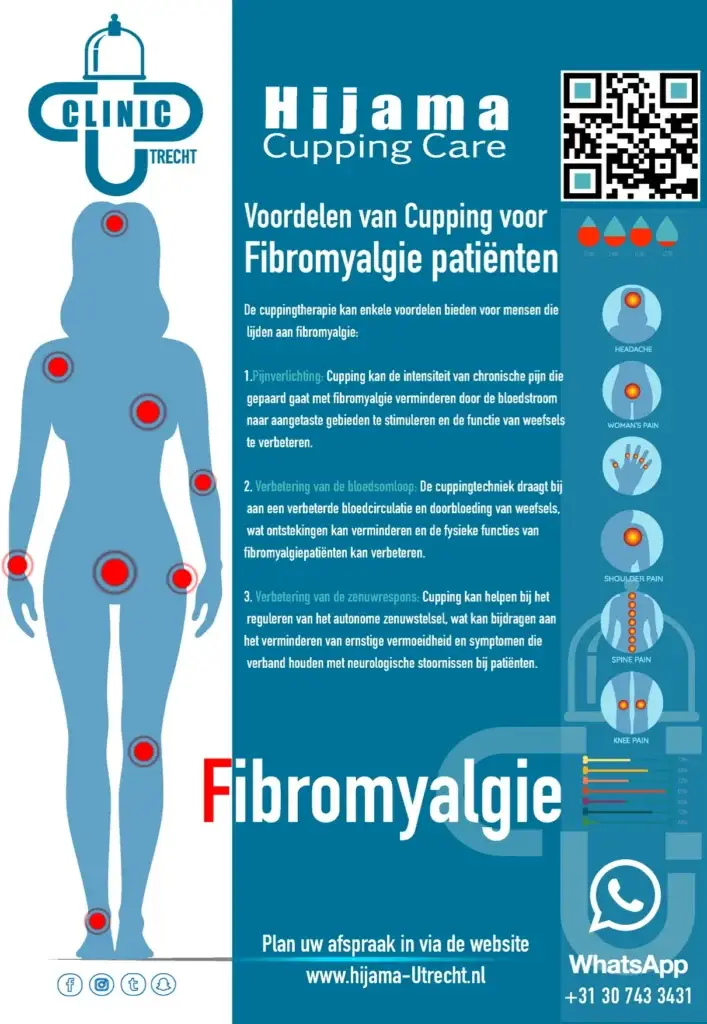 Hijama bij fibromyalgie