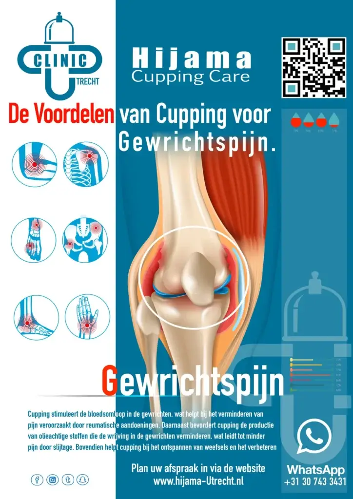 Hijama behandeling voor gewrichtspijn