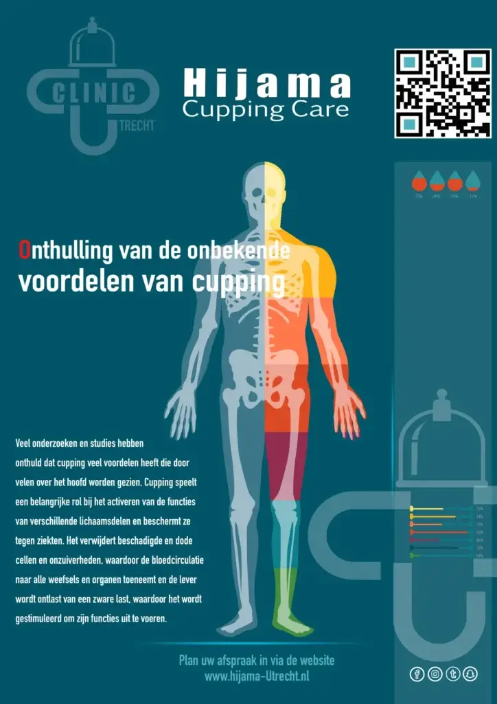 Hijama voor het lichaam