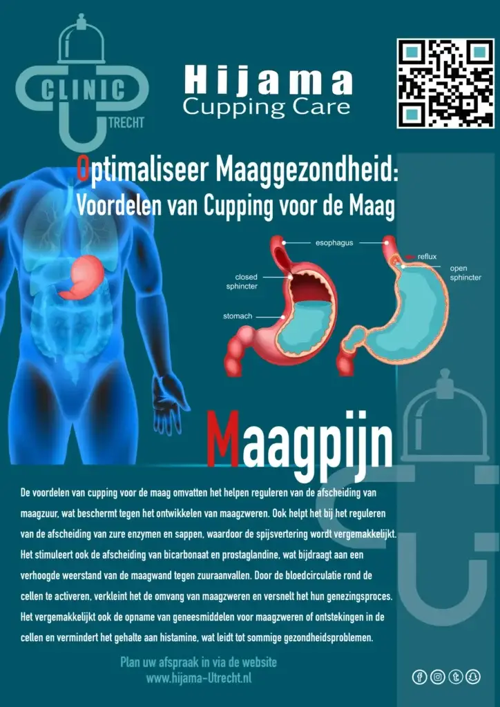 Hijama bij maagpijn
