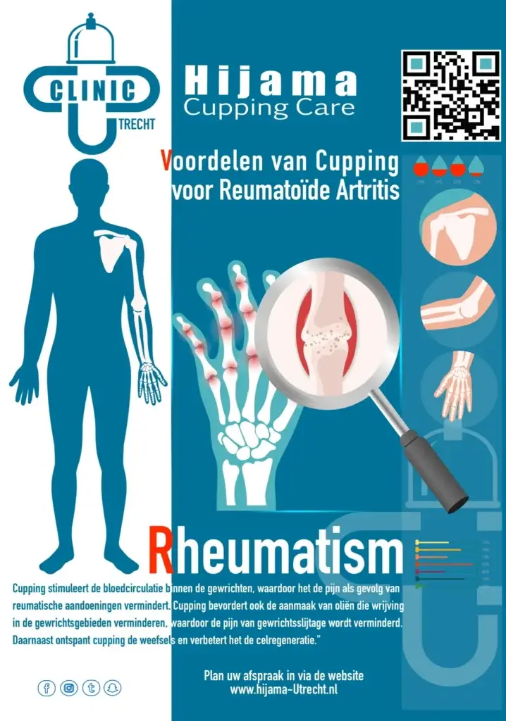 Hijama bij reuma