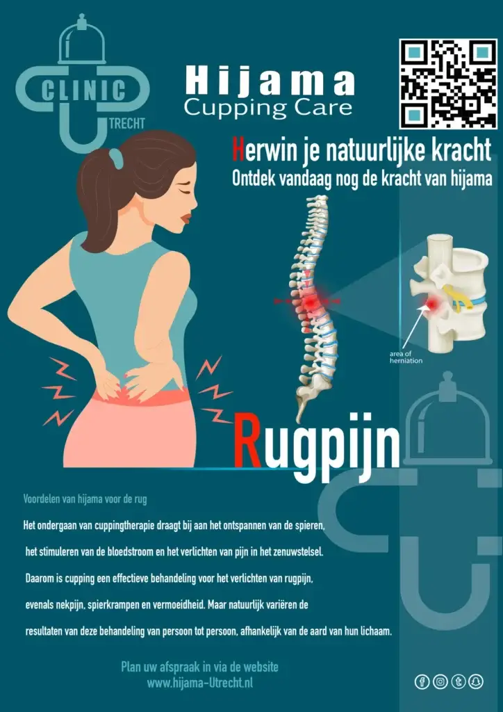 Hijama behandeling voor rugpijn